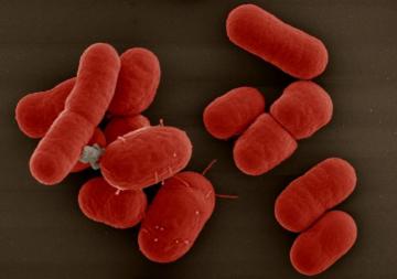 Laminate AICA diệt khuẩn giúp bảo vệ bạn và cả nhà trước vi khuẩn Klebsiella